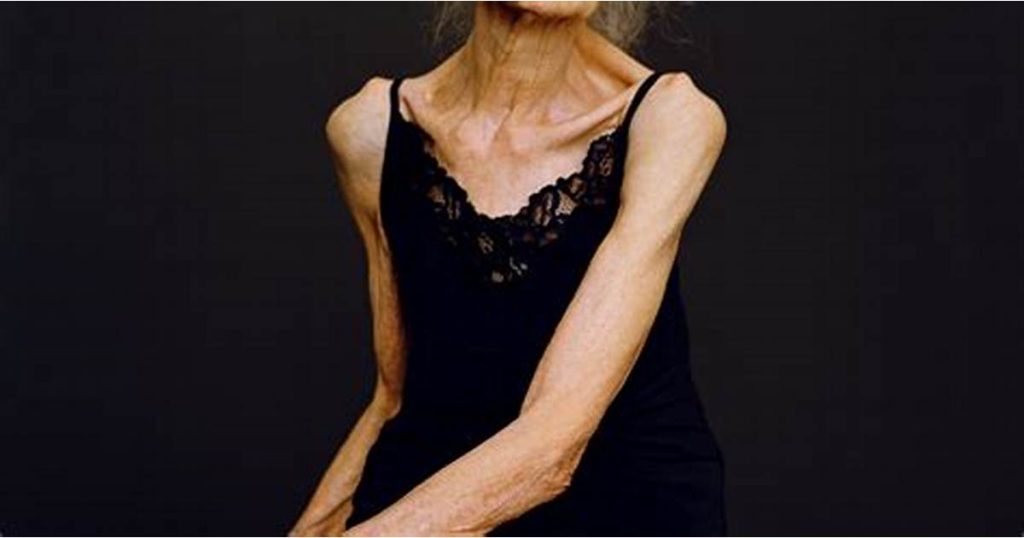 psychodietetyka leczenie anoreksja bulimia kompulsywne objadanie ośrodek zamknięty stacjonarny mazowieckie warszawa grodzisk mazowiecki filar